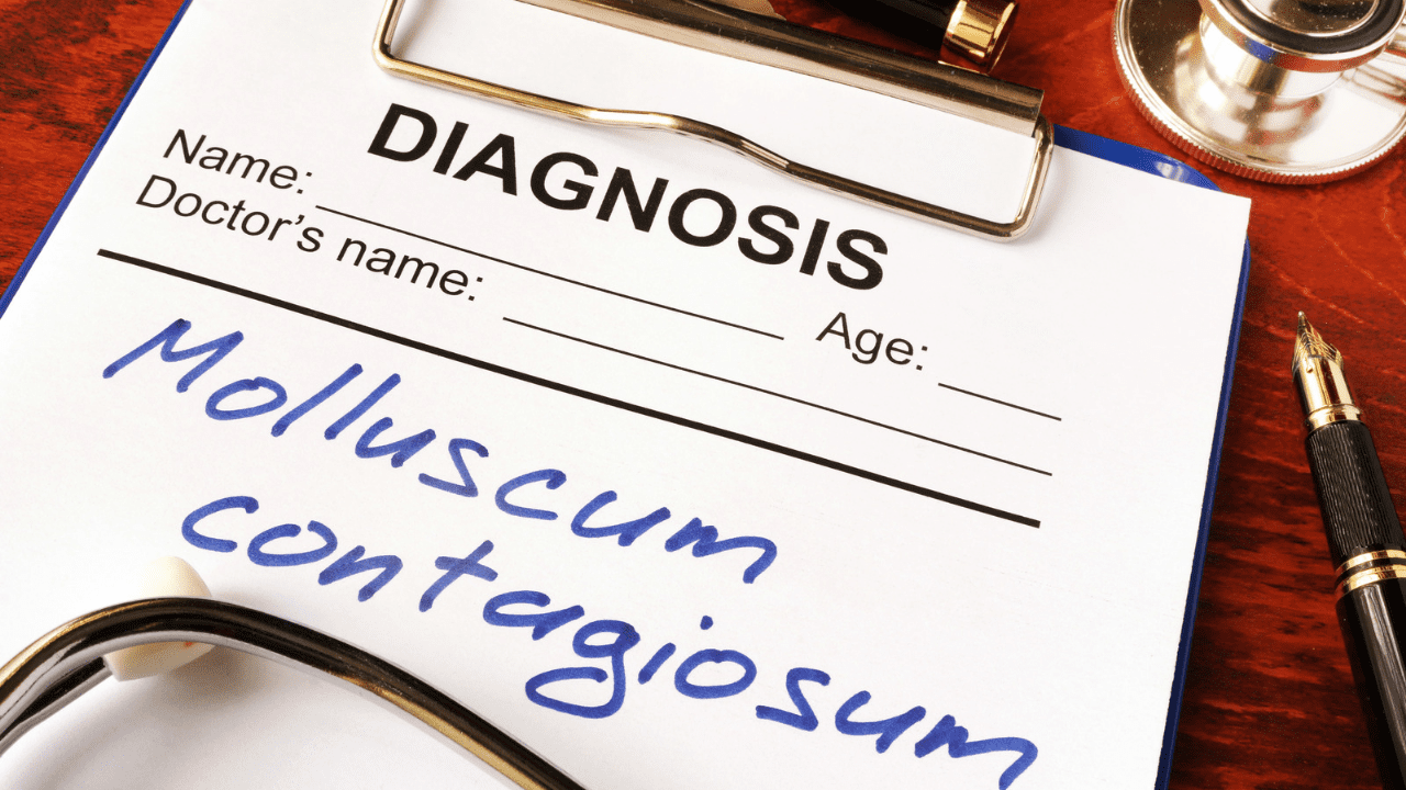 Diagnosis and methods to get rid of molluscum contagiosum.